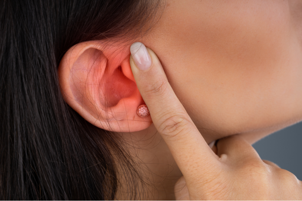 OTOPLASTY (CAULIFLOWER EARS AESTHETICS)